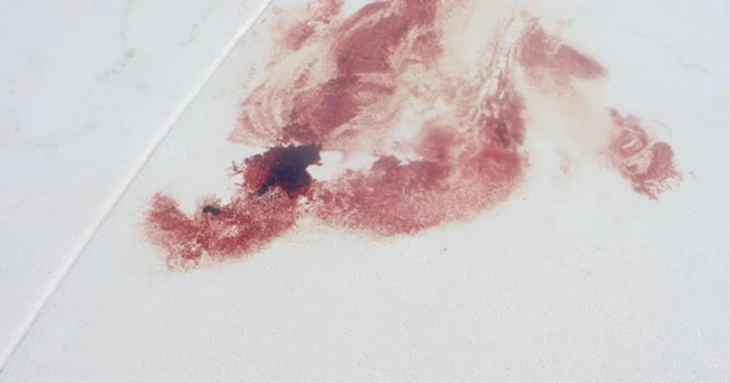 Blood on the overhang